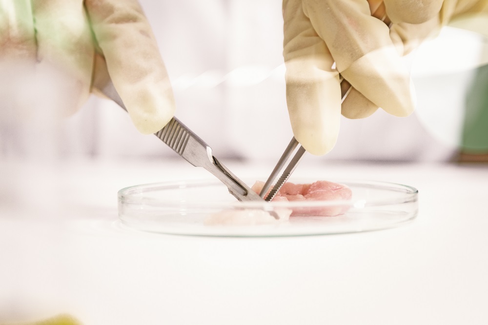 Linking intestinal activity to the market - Agrimprove - Agrimprove